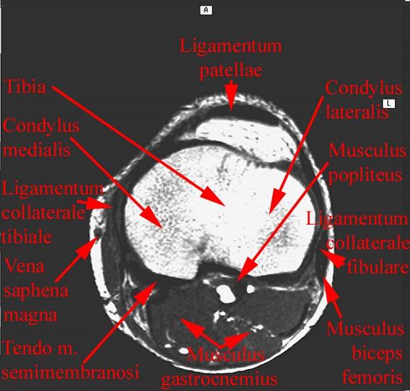 anatomia radiologiczna - 18.jpg